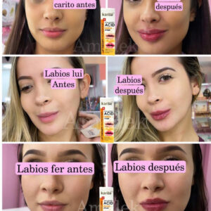 Voluminizador de labios