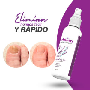 TERBIFIN PARA HONGOS EN MANOS Y PIES A.V