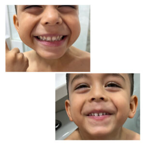 CREMA DENTAL DESMANCHADORA