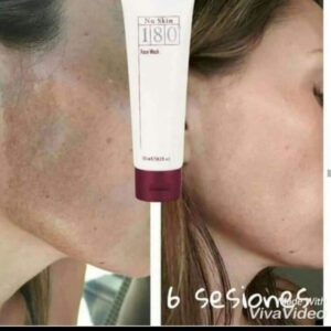 Crema para manchas
