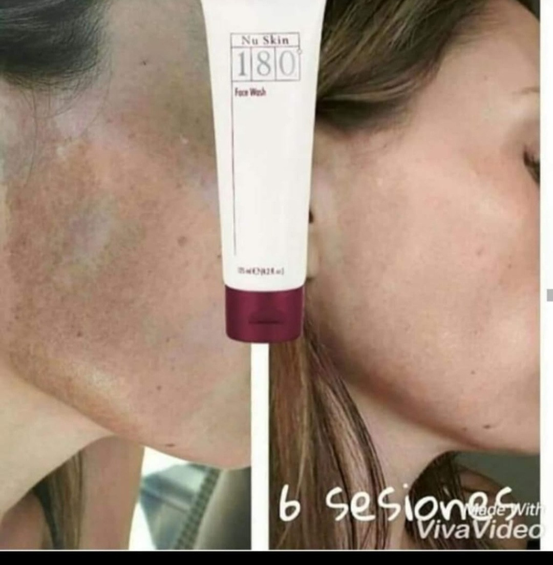 Crema para manchas