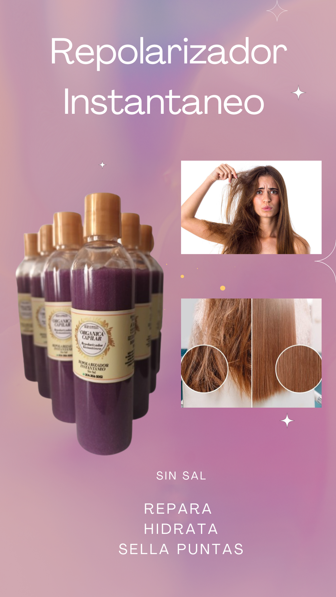 Repolarizador Instantaneo