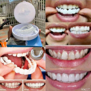🥇Prótesis dental carilla dental funda